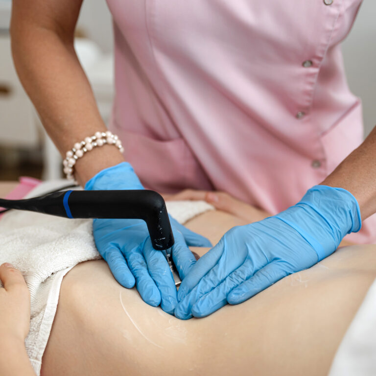 Fizjoterapia rozejścia powłok brzucha (diastasis recti)